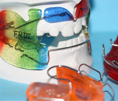 Funktionskieferorthopädische Geräte